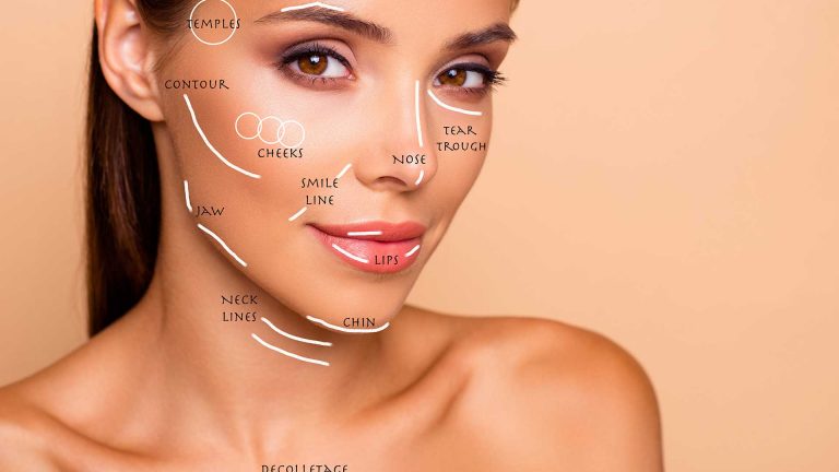 Things you must know about Dermal Fillers